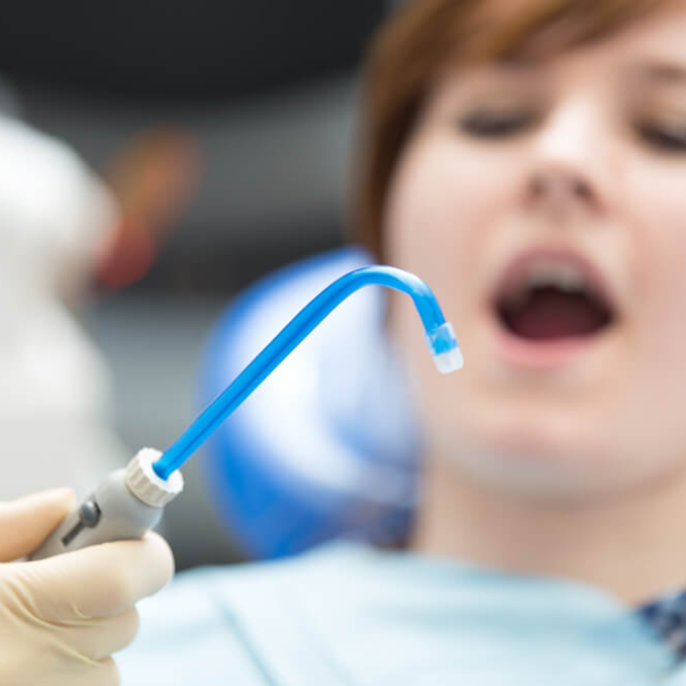 100pcs Euronda Monoart Disposable Saliva Ejectors EM15 - Blue Lagoon